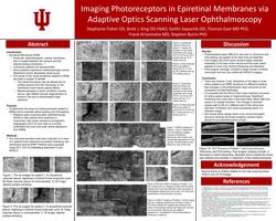 Imaging Photoreceptors in Epiretinal Membranes via Adaptive Optics Scanning Laser Ophthalmoscopy